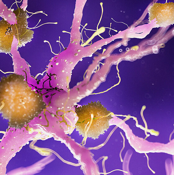 New Study Suggests THC and CBD Could Help Treat Agitation in Dementia Patients